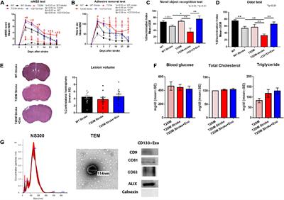 Therapeutic effects of CD133 + Exosomes on liver function after stroke in type 2 diabetic mice